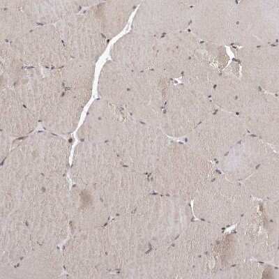 Immunohistochemistry-Paraffin: MYD118 Antibody [NBP1-87990]