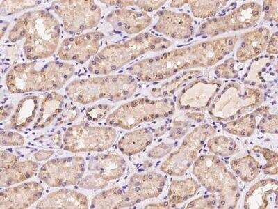 Immunohistochemistry-Paraffin: MYD118 Antibody [NBP3-06405]