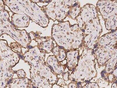 Immunohistochemistry-Paraffin: MYD118 Antibody [NBP3-06405]