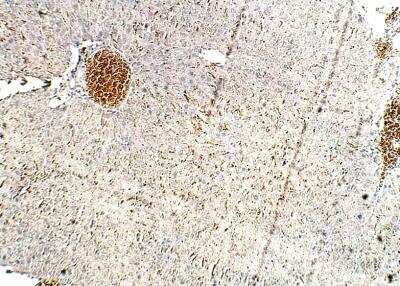 Immunohistochemistry-Paraffin: MYD118 Antibody [NBP3-12326]