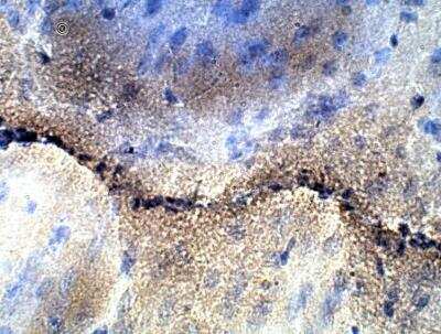 Immunohistochemistry-Paraffin: MYD118 Antibody [NBP3-12326]