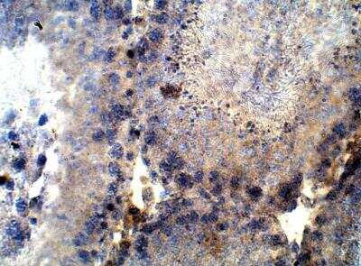 Immunohistochemistry-Paraffin: MYD118 Antibody [NBP3-12326]