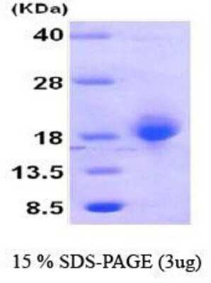 SDS-PAGE: Recombinant Human MYD118 Protein [NBC1-18436]