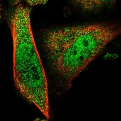 Immunocytochemistry/ Immunofluorescence: MYEOV2 Antibody [NBP1-94167]