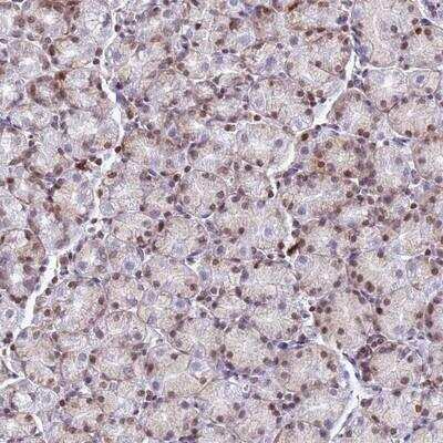 Immunohistochemistry-Paraffin: MYEOV2 Antibody [NBP1-94167]