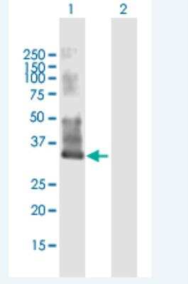 Western Blot: MYEOV2 Antibody [H00150678-B01P-50ug]