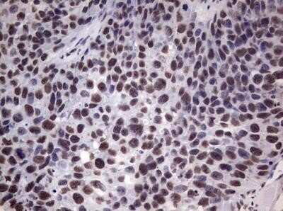 Immunohistochemistry: MYF-5 Antibody (OTI2G5) - Azide and BSA Free [NBP2-72855]