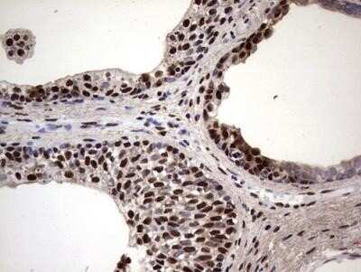 Immunohistochemistry: MYF-5 Antibody (OTI2G5) - Azide and BSA Free [NBP2-72855]