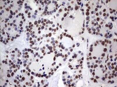 Immunohistochemistry: MYF-5 Antibody (OTI2G5) - Azide and BSA Free [NBP2-72855]