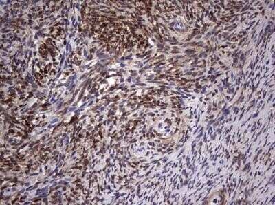 Immunohistochemistry: MYF-5 Antibody (OTI2G5) - Azide and BSA Free [NBP2-72855]