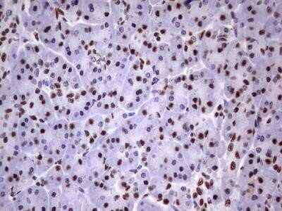 Immunohistochemistry: MYF-5 Antibody (OTI2G5) - Azide and BSA Free [NBP2-72855]