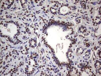 Immunohistochemistry-Paraffin: MYF-5 Antibody (OTI2G5) [NBP2-44245]