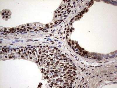 Immunohistochemistry-Paraffin: MYF-5 Antibody (OTI2G5) [NBP2-44245]
