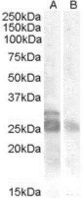 Western Blot: MYF-5 Antibody [NB100-93518]