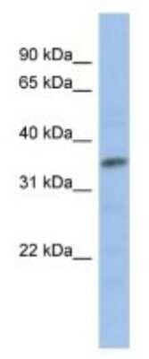 Western Blot: MYF-5 Antibody [NBP3-10926]