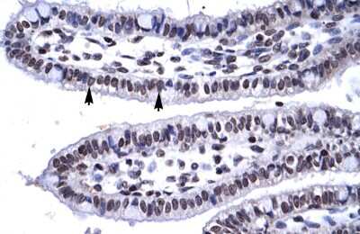 Immunohistochemistry: MYF6 Antibody [NBP3-09188]