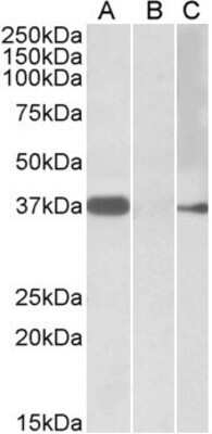 Western Blot: MYF6 Antibody [NBP1-52030]