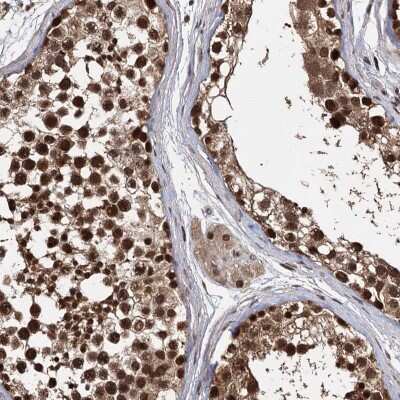 Immunohistochemistry: MYG1 Antibody [NBP2-38422]