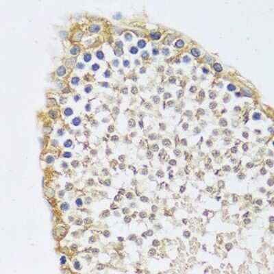 Immunohistochemistry-Paraffin: MYG1 Antibody - Azide and BSA Free [NBP3-03741]