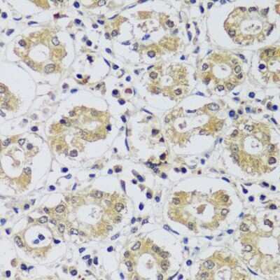 Immunohistochemistry-Paraffin: MYG1 Antibody - Azide and BSA Free [NBP3-03741]