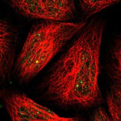 Immunocytochemistry/ Immunofluorescence: MYH Antibody [NBP1-87743]