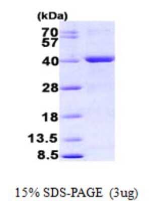 SDS-PAGE: Recombinant E. coli MYH His Protein [NBP2-22653]