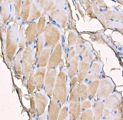 Immunohistochemistry-Paraffin: MYH4 Antibody - BSA Free [NBP3-05634]