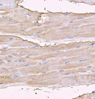 Immunohistochemistry-Paraffin: MYH4 Antibody - BSA Free [NBP3-05634]