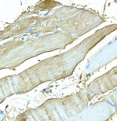 Immunohistochemistry-Paraffin: MYH4 Antibody - BSA Free [NBP3-05634]