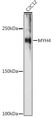 Western Blot: MYH4 AntibodyBSA Free [NBP3-05634]