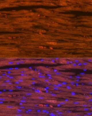 Immunohistochemistry: MYH6/7 Antibody (6V0G1) [NBP3-16520]