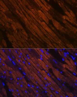 Immunohistochemistry: MYH6/7 Antibody (6V0G1) [NBP3-16520]