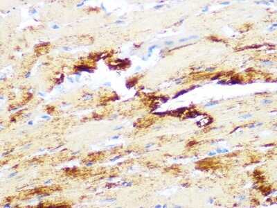 Immunohistochemistry-Paraffin: MYH6/7 Antibody (6V0G1) [NBP3-16520]