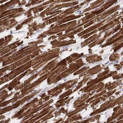 Immunohistochemistry-Paraffin: MYH6 Antibody (CL2148) [NBP2-36744]
