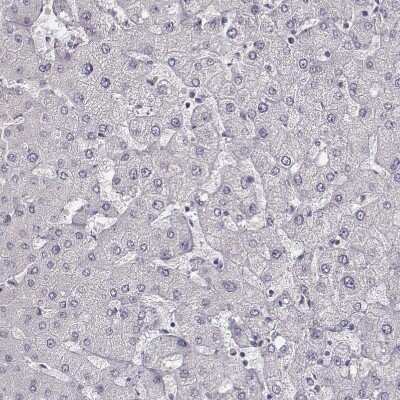 Immunohistochemistry-Paraffin: MYH6 Antibody (CL2148) [NBP2-36744]