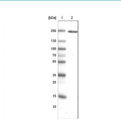 Western Blot: MYH6 Antibody (CL2148) [NBP2-36744]