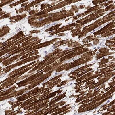 Immunohistochemistry-Paraffin: MYH6 Antibody (CL2155) [NBP2-36745]