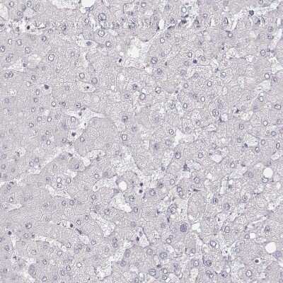 Immunohistochemistry-Paraffin: MYH6 Antibody (CL2155) [NBP2-36745]