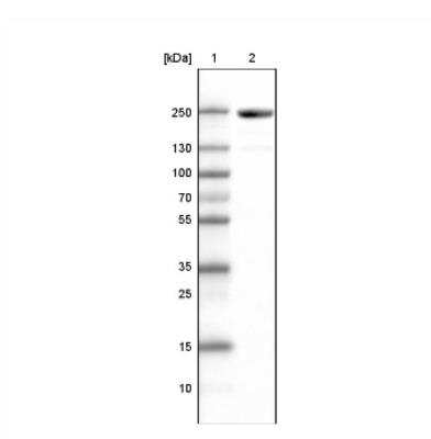 Western Blot: MYH6 Antibody (CL2155) [NBP2-36745]