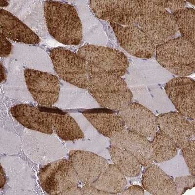 Immunohistochemistry-Paraffin: MYH6 Antibody (CL2162) [NBP2-36746]
