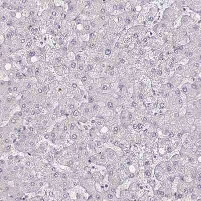 Immunohistochemistry-Paraffin: MYH6 Antibody (CL2162) [NBP2-36746]