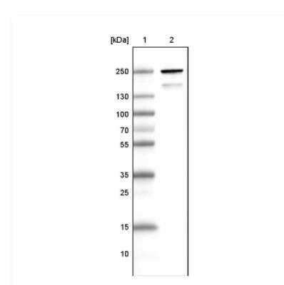 Western Blot: MYH6 Antibody (CL2162) [NBP2-36746]