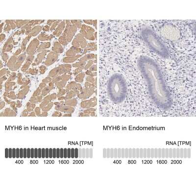Immunohistochemistry-Paraffin: MYH6 Antibody [NBP1-88120]