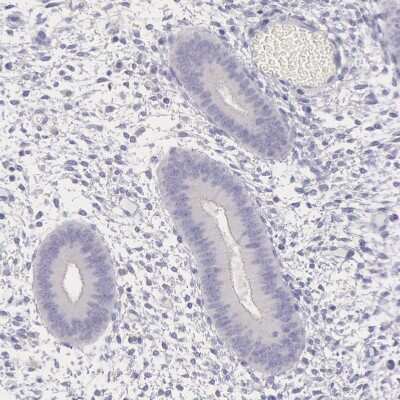 Immunohistochemistry-Paraffin: MYH6 Antibody [NBP1-88120]