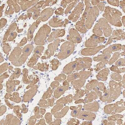 Immunohistochemistry-Paraffin: MYH6 Antibody [NBP1-88120]