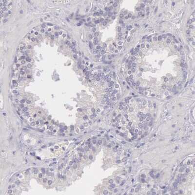Immunohistochemistry-Paraffin: MYH6 Antibody [NBP1-88120]