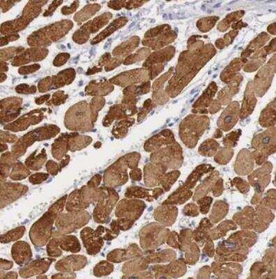 Immunohistochemistry-Paraffin: MYH7 Antibody [NBP2-52737]