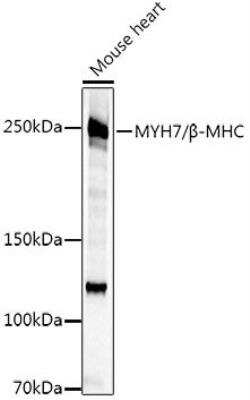 Western Blot: MYH7 AntibodyAzide and BSA Free [NBP2-94079]