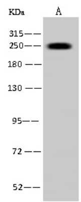 Western Blot: MYH7 Antibody [NBP2-97775]