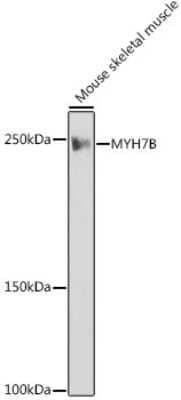 Western Blot: MYH7B Antibody (7W8J3) [NBP3-16495]